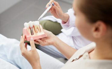 Implantologie – oder: Wie Zähne zurückgezaubert werden können